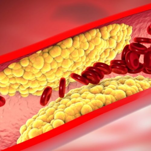 ¿Qué significa colesterol “bueno” y colesterol “malo”?